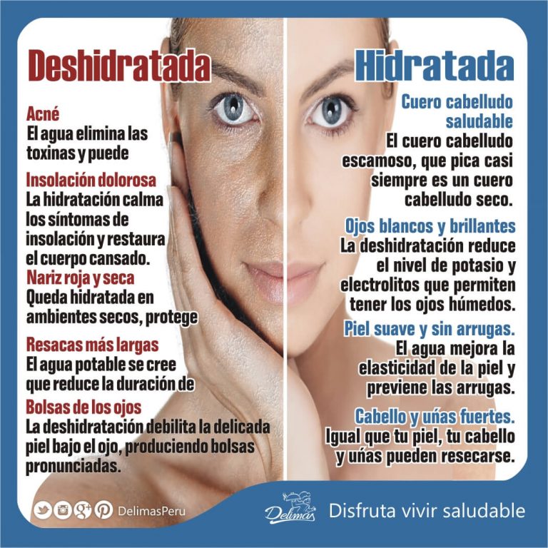 Piel Seca O Deshidratada Rehidrata Tu Piel De Manera Natural Blog